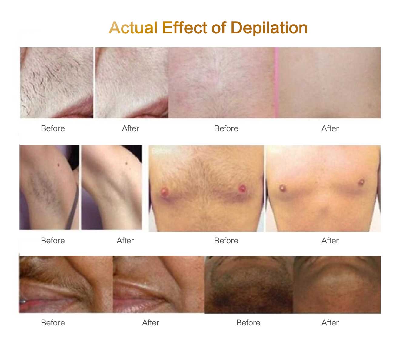 before and after treatment