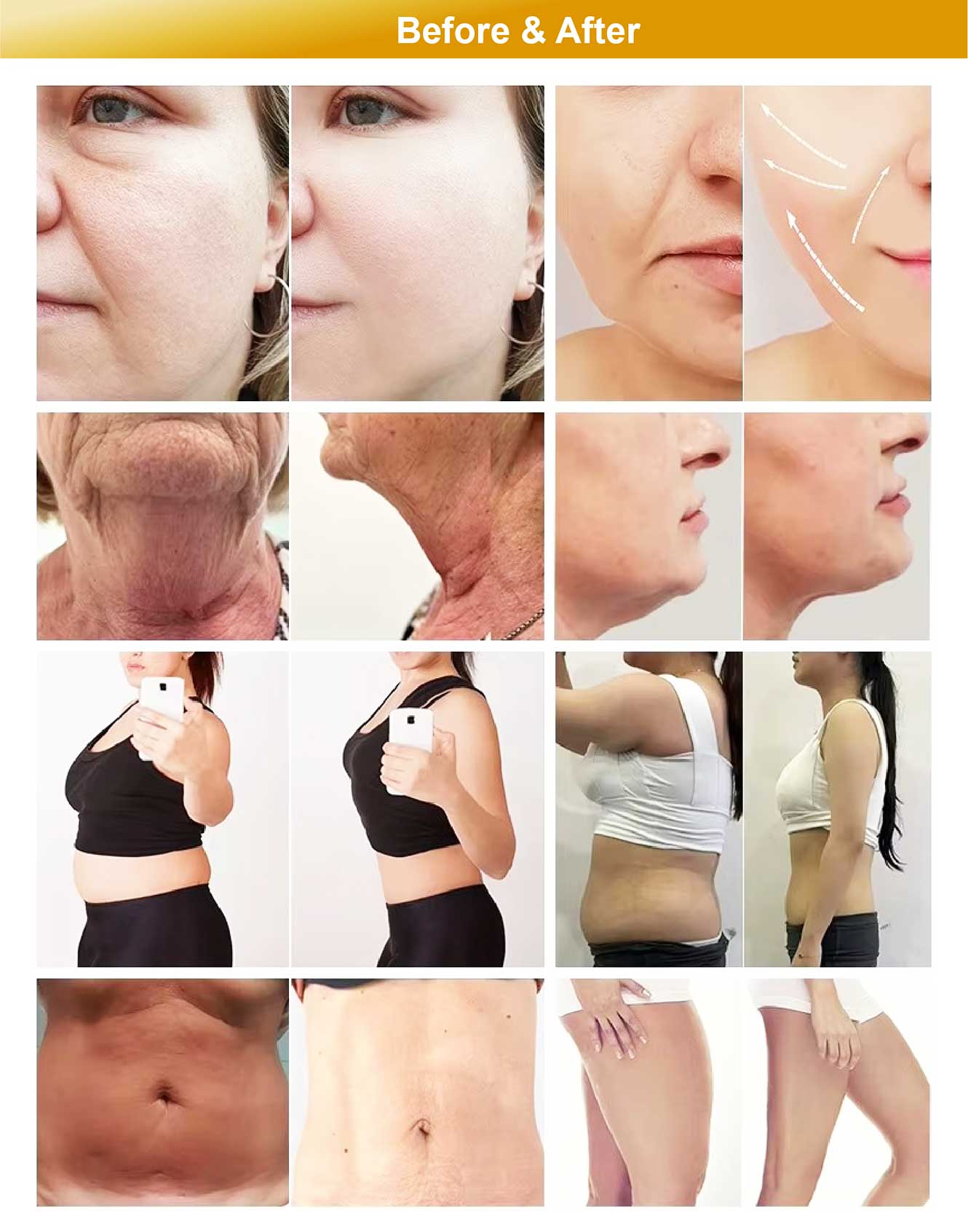 body slimming comparison