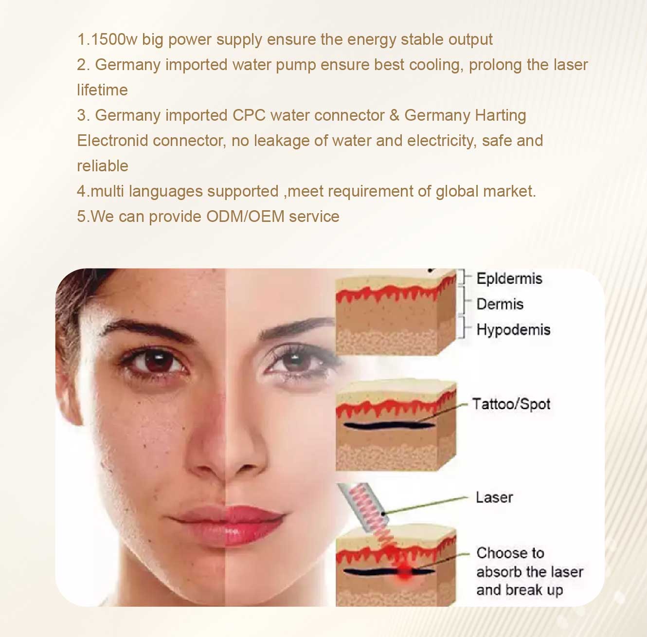 tattoo removal machine