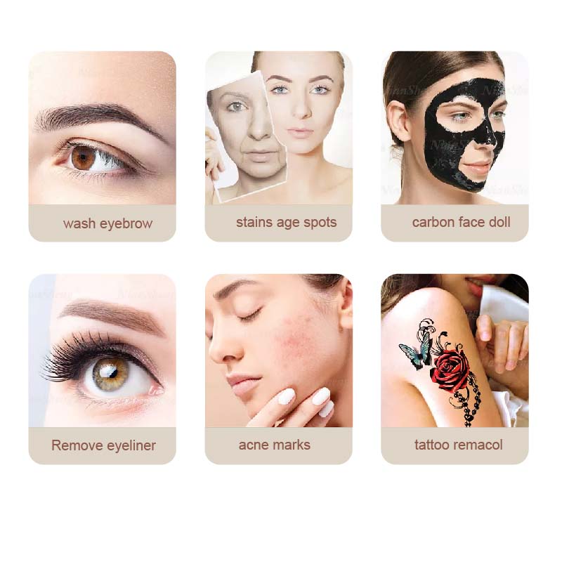 ND yag laser treatment